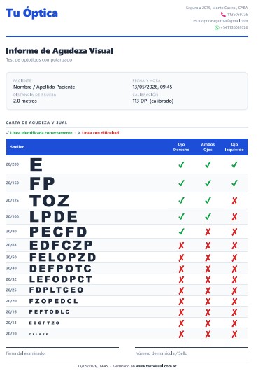 Informe PDF de agudeza visual generado por TestVisual